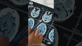 Comprendre la Radiographie  Une Fenêtre sur Votre Santé 💡🔍 [upl. by Namra359]