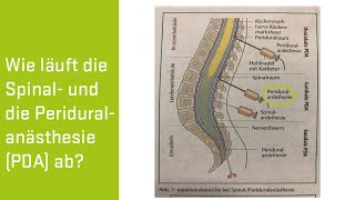 PDA Schmerzarme Geburt in der Privatklinik Döbling [upl. by Nalor]