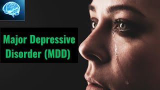 Major Depressive Disorder MDD [upl. by Tnomel130]