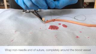 Ligation Of Blood Vessel  Stick Tie Technique [upl. by Pradeep]