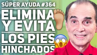 SÚPER AYUDA 364 Cómo Eliminar Y Evitar Los Pies Hinchados [upl. by Inalaehon808]