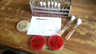 GTT Germ Tube Test Mycology [upl. by Garreth278]