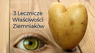 Bolą Cię Oczy 3 Ziemniaczane Sposoby na Opuchnięte Zmęczone Sińce Jęczmień [upl. by Melania]