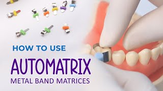 How to use Automatrix Metal Band Matrices [upl. by Enavi]