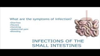 Infections of the small bowel [upl. by Shelbi]