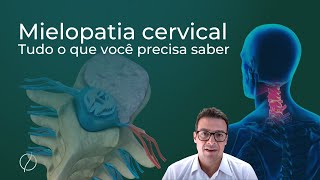 Mielopatia cervical Tudo o que você precisa saber sintomas e cirurgia [upl. by Sorkin]