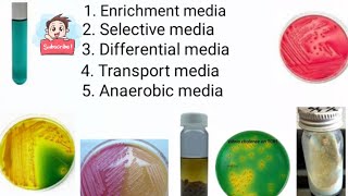 Enrichment media Selective media Differential media Transport media Anaerobic media part 4 [upl. by Aleb602]