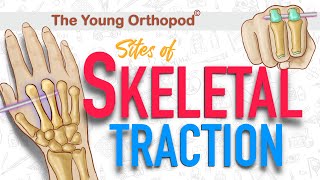 Skeletal Traction Sites  ANIMATION  USMLE  Anatomy Lecture  NEET PG MRCS The Young Orthopod [upl. by Aimahc]