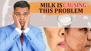 Milk Is Causing Pigmentation AcneIndigestion And Constipation  Dr Vivek Joshi [upl. by Mueller]