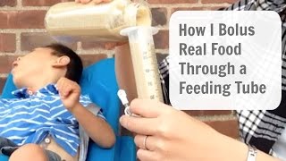 How to Bolus Feed Through a GTube REAL FOOD [upl. by Fugate]