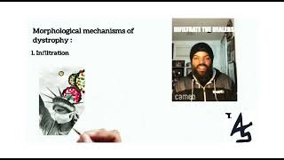 Dystrophy  Mechanism amp Classification [upl. by Jacki687]