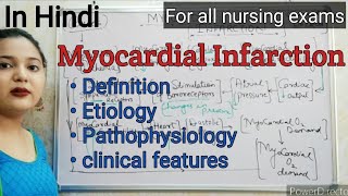 Myocardial Infarction  part 1 [upl. by Lucio]