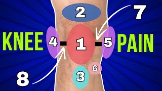 My Knee Hurts Here 10 Typical Pain Spots And What They Mean [upl. by Zerimar]