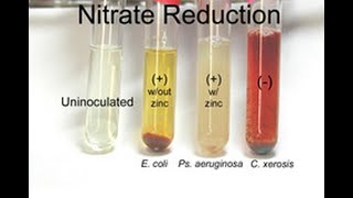 Nitrate Reduction Test [upl. by Ecirtaemed]