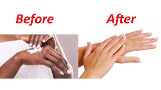 how to get soft whiten amp beautiful hands  Ladies Talk [upl. by Anerb]