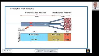 Ischemia Due to Coronary Microvascular Dysfunction CMVD Including INOCA amp ANOCA [upl. by Tebasile387]