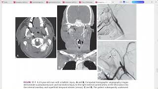 EMERGENCY RADIOLOGY REQUISITES [upl. by Caassi66]