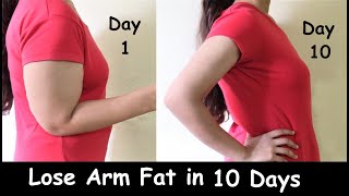 Lose Arm Fat in 1 WEEK  Get Slim Arms  Arms Workout Exercise for Flabby Arms amp Tone Sagging Arms [upl. by Hammel378]