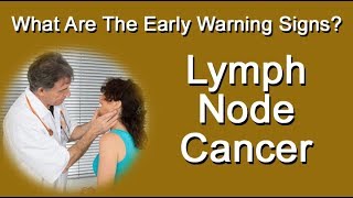 What Are The Early Warning Signs Of Lymph Node Cancer [upl. by Negam]