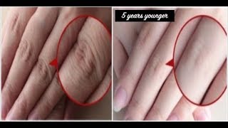 How to Make Your Hands Look 5 Years Younger Overnight Wrinklefree smooth fair hands [upl. by Clemente709]