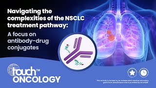 Navigating the complexities of the NSCLC treatment pathway A focus on antibodydrug conjugates [upl. by Gamin]