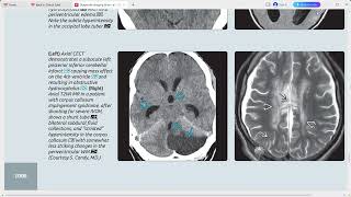 BRAIN DIAGNOSTIC IMAGING SERIES [upl. by Digirb]