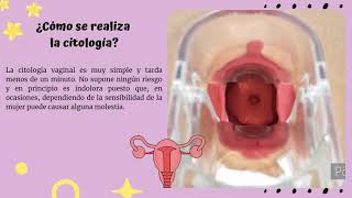 ¿Cómo se realiza la citología CervicoVaginal [upl. by Stanislaus]