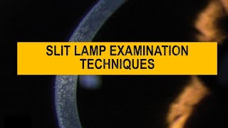 Diffuse vs Focal  Optical section parallel pipe  conical illumination  SLIT LAMP techniques [upl. by Dido]