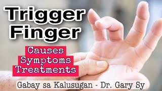 Trigger Finger Causes Symptoms amp Treatments  Dr Gary Sy [upl. by Dymoke]