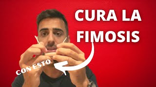 Tratamiento Casero y Natural Para Curar La Fimosis Sin Circuncisión Cómo Hacer Que Tu Prepucio Baje [upl. by Idnim]