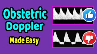 Obstetric Doppler Made Easy [upl. by Enirahtak373]