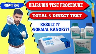 Total amp Direct Bilirubin test procedure practical video पीलिया टेस्टjaundice testserum bilirubin [upl. by Aramas]