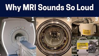 What Makes The Different MRI Scan Sounds Knocking to Rhythmic Chirping MRI Sounds Explained [upl. by Latrell]