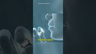 Wireless Capsule Endoscopy [upl. by Kaufman]