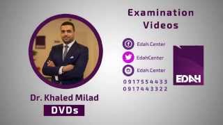 Brief Thyroid Examination  DrKhaled Milad [upl. by Irv]