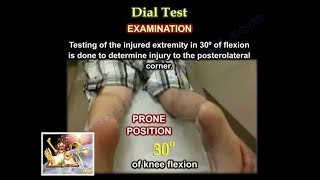 Dial Test  Everything You Need To Know  Dr Nabil [upl. by Cleary733]