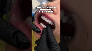 Da li biste i vi radili fasete dentist [upl. by Leoy506]