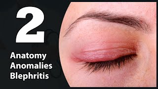 2 Eye lids Anatomy Congenital anomalies amp Blephritis [upl. by Uella755]