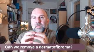 AskJJ Can we remove a dermatofibroma [upl. by Levesque698]