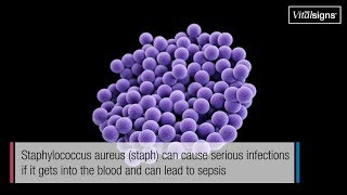 Staph infections can kill March 2019 Vital Signs [upl. by Shantha]