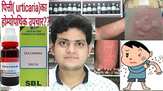 Urticaria Homeopathic medicine for Urticaria explain [upl. by Yralih24]