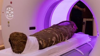 Unwrapping mummy secrets with Xrays [upl. by Ahsasal]