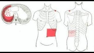 Why Pleurisy pain  Pleuritis pain is referred to the anterior abdominal wall [upl. by Brod626]