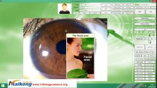 HOW TO USE THE ENGLISH PRO IRIDOLOGY SOFTWARE Video [upl. by Lativa]