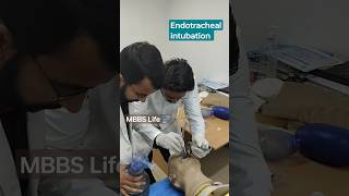 Intubation procedure endotracheal intubation shorts doctorslife medical mbbs [upl. by Neirrad]