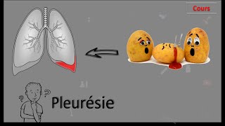 Pleurésie 🤒🤔 Tous ce que vous devez connaître  Cours  PneumoPhtisiologie [upl. by Jacey]