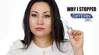 WHY I STOPPED USING DIFFERIN GEL  ADAPALENE GEL 01 ACNE TREATMENT  Zulayla [upl. by Minabe476]