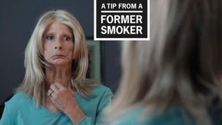 CDC Tips From Former Smokers  Terrie H’s Tip Ad [upl. by Kelbee81]