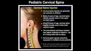 Pediatric Cervical Spine Injuries  Everything You Need To Know  Dr Nabil Ebraheim [upl. by Adnowat]