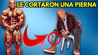 El CULTURISTA que PERDIO su PIERNA  Que Le PASO REALMENTE a FLEX WHEELER [upl. by Ayekat240]